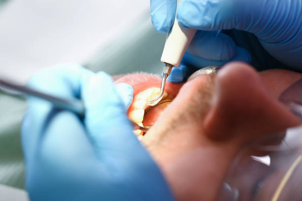 Best Same-Day Emergency Dentist in Cecil Bishop, PA